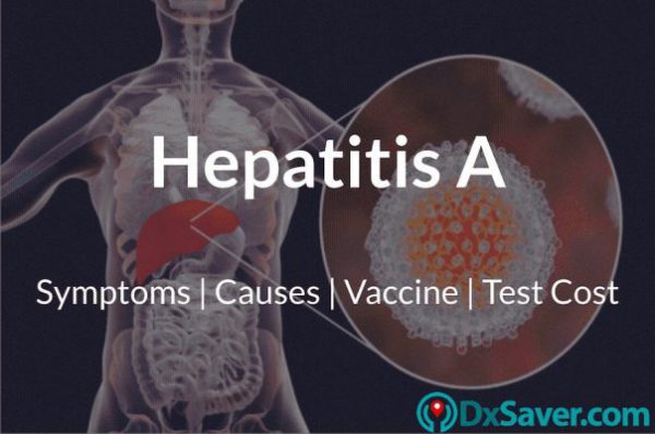 Know more about Hepatitis A symptoms, causes, treatment and test cost