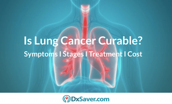 Know about lung cancer stages 4 & 3. Also about early symptoms, types & causes