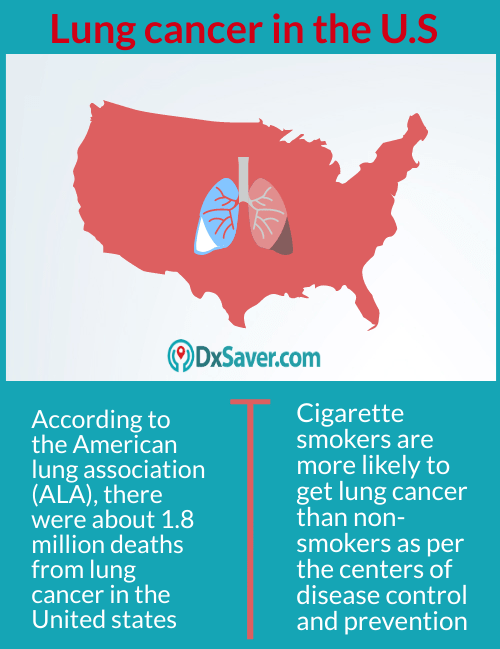 Lung cancer survival rate in the U.S.