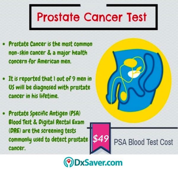 Know more about the causes of prostate cancer in the U.S. & PSA test cost