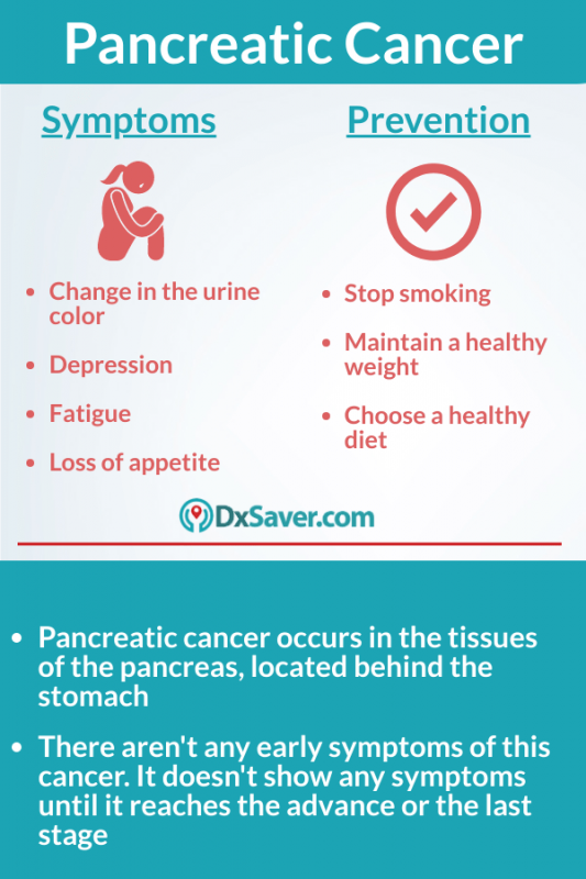 Stages of Pancreatic cancer-Know more about pancreatic cancer stage 4