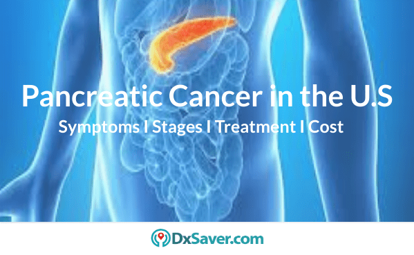 Pancreatic cancer stages-more about test for pancreatic cancer & treatments