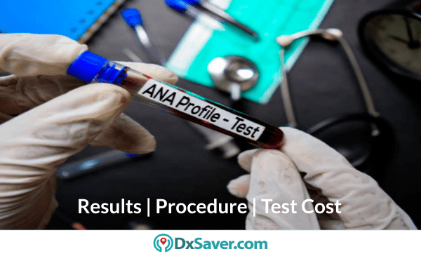 ANA test cost, know more about the results & procedures