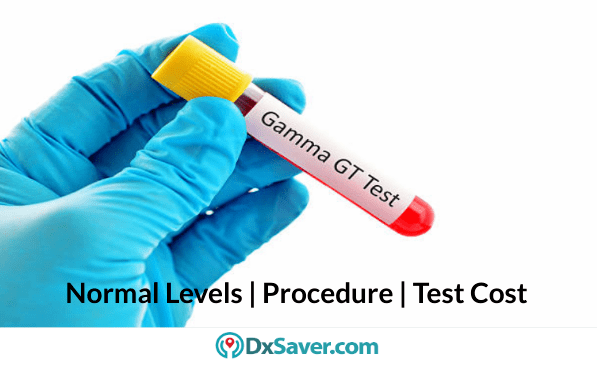 What is GGT blood test? Know about Labs for GGT test & more