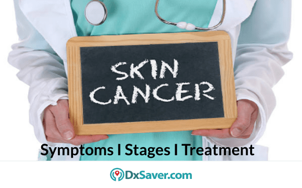 Know more about Skin cancer types, causes, symptoms, stages & treatment
