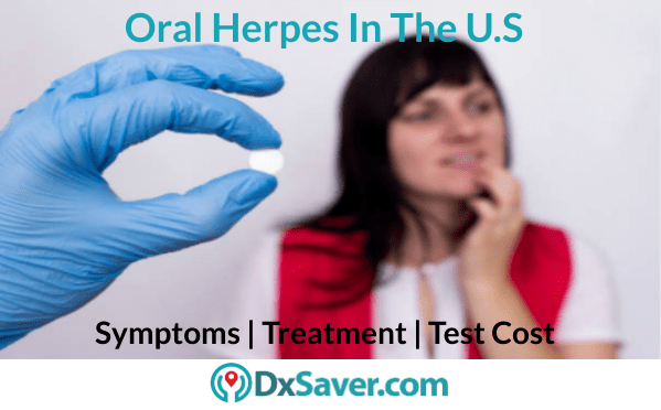 Symptoms of oral herpes and its test kit cost in the U.S