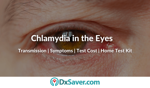 Chlamydia in Eye and Other Symptoms on Men and Women