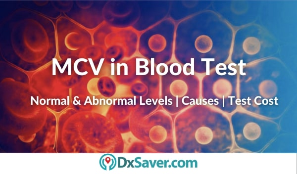 What is MCV in Blood Test, More on Normal Levels, High & Low MCV values