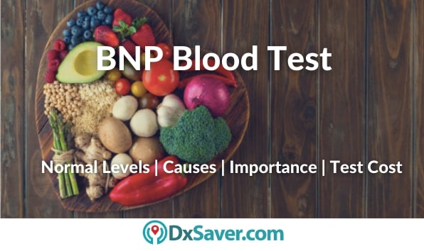 What is BNP Blood Test & High BNP levels mean?