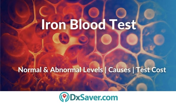 Iron Blood Test Results, High & Low levels of iron causes and more