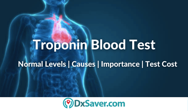 What is Troponin Blood Test & normal levels & high levels mean