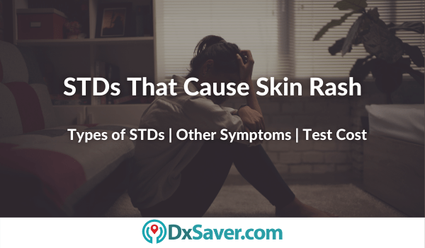 STDs That Cause Skin Rash – DxSaver.com Types of STDs that cause Skin Rash and itching symptoms in men and women