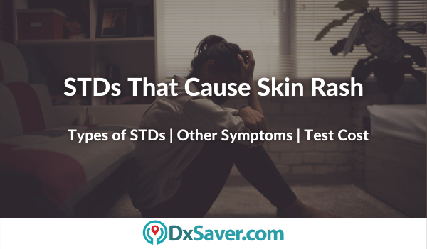 Typses of STDs that cause skin rash and itching symptoms in men and women