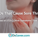 STDs that Cause Sore Throat Symptoms