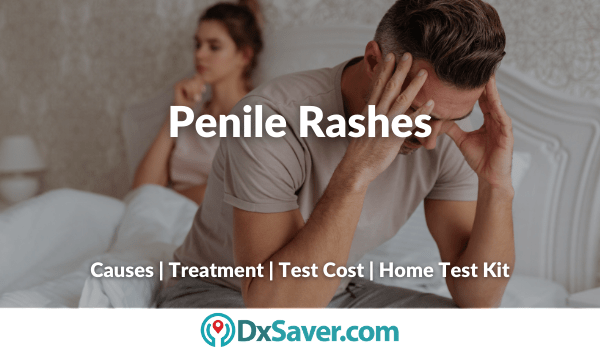 Causes and Symptoms of STDs in Men and Penile Rashes
