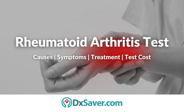 Rheumatoid Arthritis