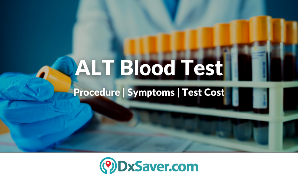 ALT blood test