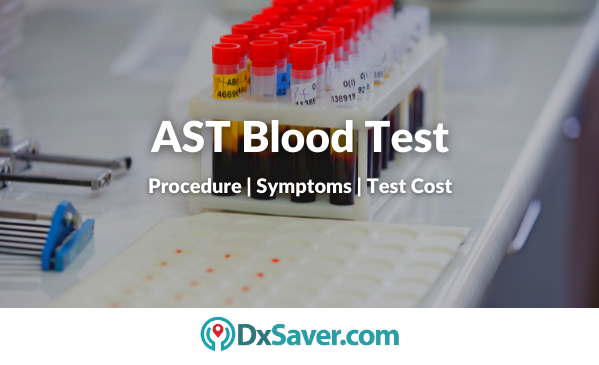 AST Blood Test