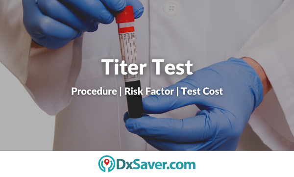 Titer Test