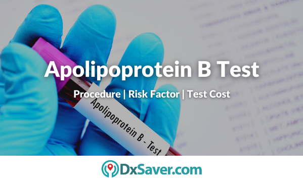 Apolipoprotein B Test