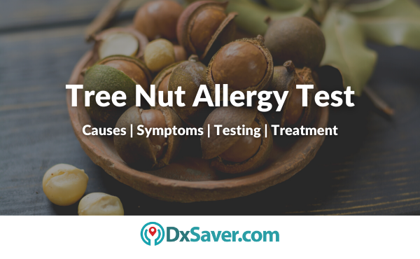 Tree Nut Allergy