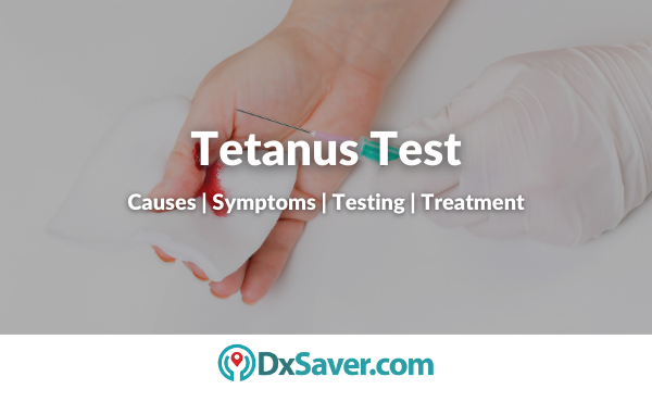What Is Tetanus? Symptoms, Causes, Diagnosis, Treatment, and Prevention