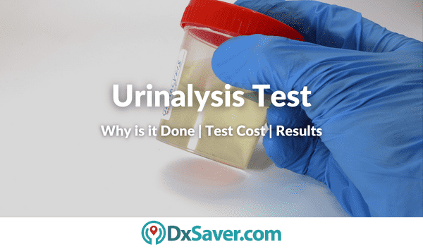 Urinalysis Testing in the US