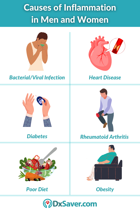 Causes of Inflammation in Men and Women