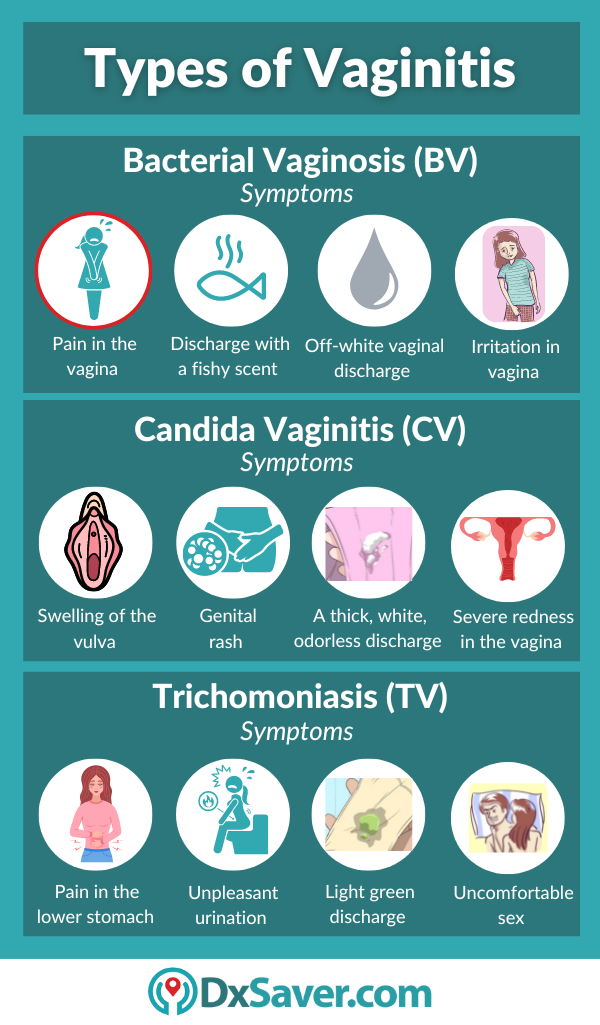 Types of Vaginitis and their symptoms