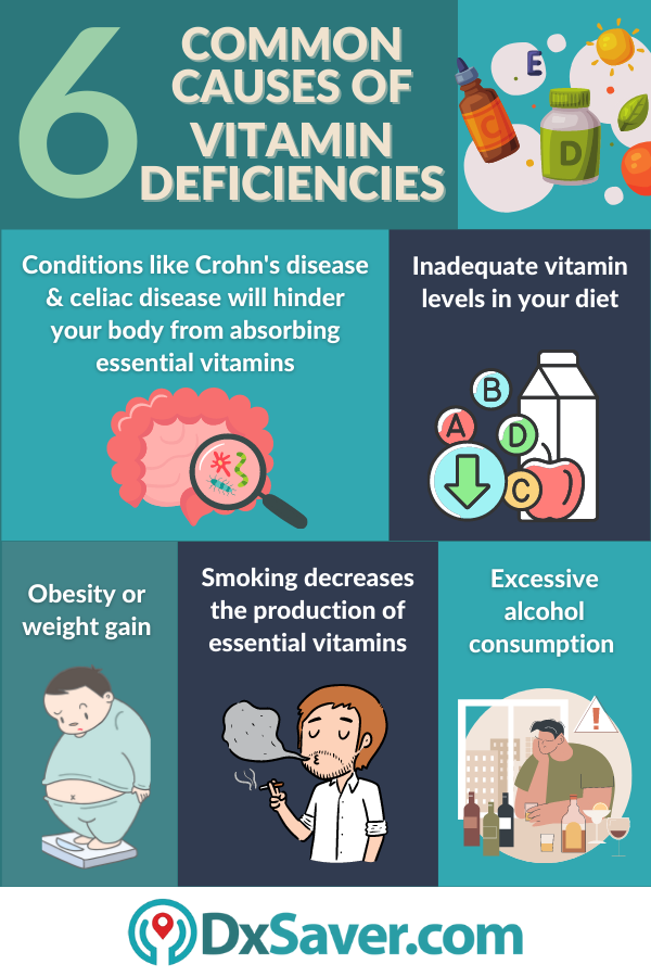 6 common causes of vitamin deficiency and need for essential vitamin test